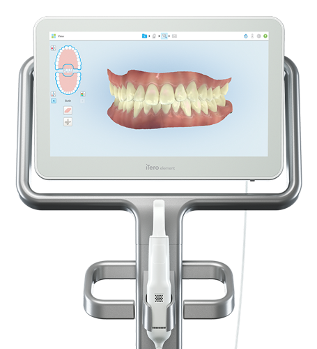 iTero Element 2 (Escaner intraoral)