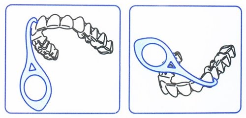 Aligners Remover (Retractor remover alineadores) colores surtidos (10 piezas)